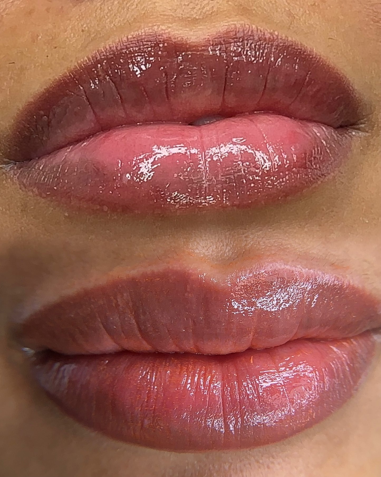 NEUTRALIZACION DE LABIOS