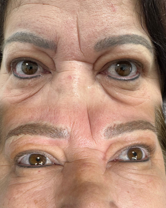 NEUTRALIZACION DE CEJAS