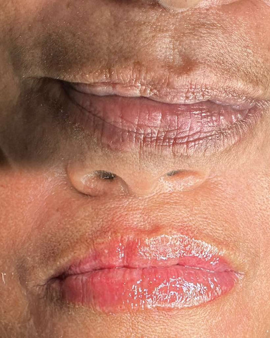 NEUTRALIZACION DE LABIOS